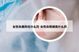 女性白癜风吃什么药 女性白斑病用什么药