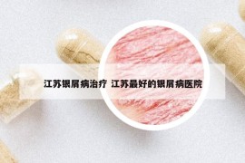 江苏银屑病治疗 江苏最好的银屑病医院