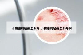 小孩胳膊起癣怎么办 小孩胳膊起癣怎么办啊