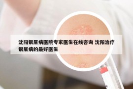 沈阳银屑病医院专家医生在线咨询 沈阳治疗银屑病的最好医生