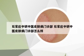 石家庄中研中医皮肤病门诊部 石家庄中研中医皮肤病门诊部怎么样