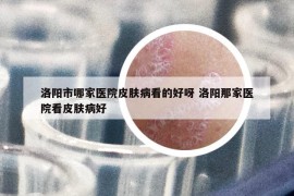 洛阳市哪家医院皮肤病看的好呀 洛阳那家医院看皮肤病好