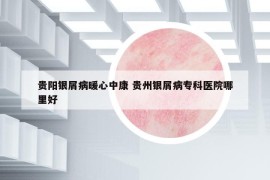 贵阳银屑病暖心中康 贵州银屑病专科医院哪里好