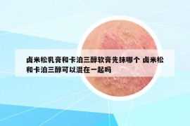 卤米松乳膏和卡泊三醇软膏先抹哪个 卤米松和卡泊三醇可以混在一起吗