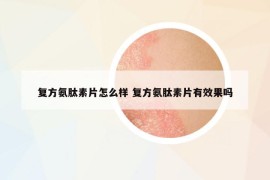 复方氨肽素片怎么样 复方氨肽素片有效果吗