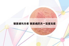 银屑病与方希 银屑病药方一百度文库