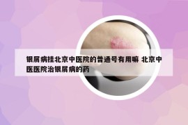 银屑病挂北京中医院的普通号有用嘛 北京中医医院治银屑病的药