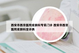 西安市西京医院皮肤科专家门诊 西安市西京医院皮肤科坐诊表