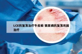 LCE抗复发治疗牛皮癣 银屑病抗复发巩固治疗