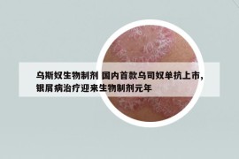 乌斯奴生物制剂 国内首款乌司奴单抗上市,银屑病治疗迎来生物制剂元年