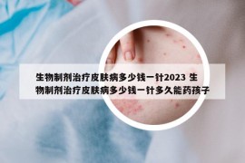 生物制剂治疗皮肤病多少钱一针2023 生物制剂治疗皮肤病多少钱一针多久能药孩子