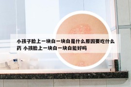 小孩子脸上一块白一块白是什么原因要吃什么药 小孩脸上一块白一块白能好吗