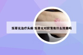 乐草元治疗头癣 乐草元对脱发有什么效果吗