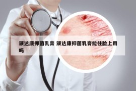 顽达康抑菌乳膏 顽达康抑菌乳膏能往脸上用吗