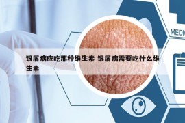 银屑病应吃那种维生素 银屑病需要吃什么维生素