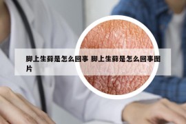 脚上生藓是怎么回事 脚上生藓是怎么回事图片