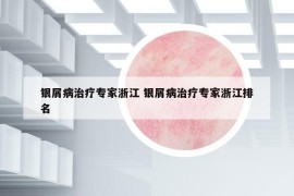 银屑病治疗专家浙江 银屑病治疗专家浙江排名