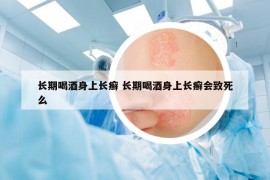 长期喝酒身上长癣 长期喝酒身上长癣会致死么