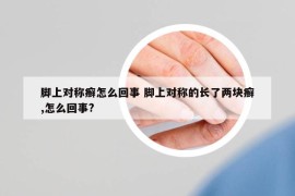 脚上对称癣怎么回事 脚上对称的长了两块癣,怎么回事?