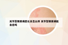 关节型银屑病恶化会怎么样 关节型银屑病能自愈吗