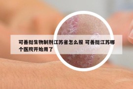 可善挺生物制剂江苏省怎么报 可善挺江苏哪个医院开始用了