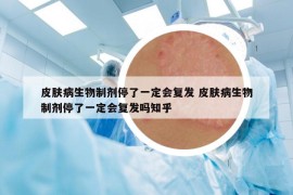 皮肤病生物制剂停了一定会复发 皮肤病生物制剂停了一定会复发吗知乎