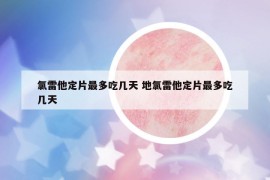 氯雷他定片最多吃几天 地氯雷他定片最多吃几天