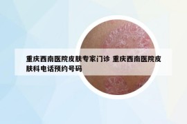 重庆西南医院皮肤专家门诊 重庆西南医院皮肤科电话预约号码