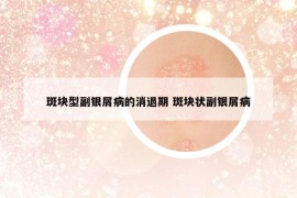 斑块型副银屑病的消退期 斑块状副银屑病