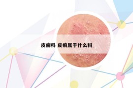 皮癣科 皮癣属于什么科