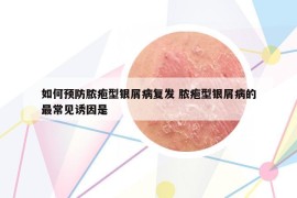 如何预防脓疱型银屑病复发 脓疱型银屑病的最常见诱因是