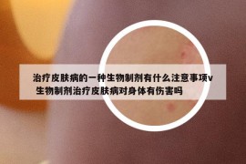 治疗皮肤病的一种生物制剂有什么注意事项v 生物制剂治疗皮肤病对身体有伤害吗