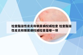 检查脂溢性皮炎和银屑病权威检查 检查脂溢性皮炎和银屑病权威检查是哪一项