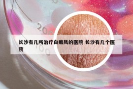 长沙有几所治疗白癜风的医院 长沙有几个医院