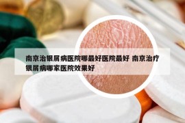 南京治银屑病医院哪最好医院最好 南京治疗银屑病哪家医院效果好