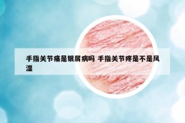 手指关节痛是银屑病吗 手指关节疼是不是风湿