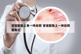 宝宝屁股上有一块白斑 宝宝屁股上一块白斑是胎记