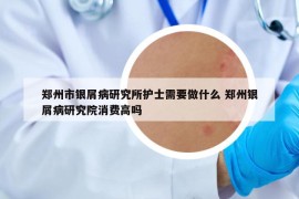 郑州市银屑病研究所护士需要做什么 郑州银屑病研究院消费高吗