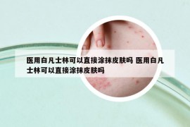 医用白凡士林可以直接涂抹皮肤吗 医用白凡士林可以直接涂抹皮肤吗