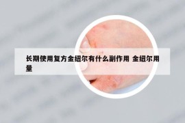 长期使用复方金纽尔有什么副作用 金纽尔用量