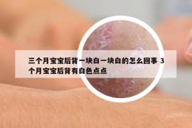 三个月宝宝后背一块白一块白的怎么回事 3个月宝宝后背有白色点点