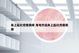 身上起红疙瘩很痒 用电热毯身上起红疙瘩很痒