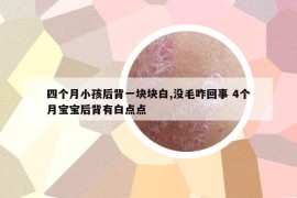 四个月小孩后背一块块白,没毛咋回事 4个月宝宝后背有白点点