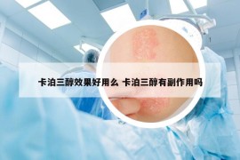 卡泊三醇效果好用么 卡泊三醇有副作用吗