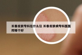 长春皮肤专科在什么位 长春皮肤病专科医医院哪个好