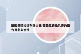 醋酸氟轻松搽剂多少钱 醋酸氟轻松乳膏的副作用怎么治疗