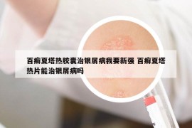 百癣夏塔热胶囊治银屑病我要新强 百癣夏塔热片能治银屑病吗