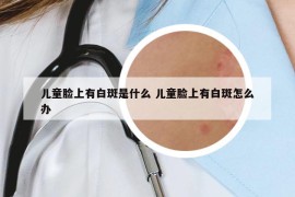 儿童脸上有白斑是什么 儿童脸上有白斑怎么办