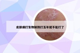 皮肤病打生物制剂打五年就不能打了