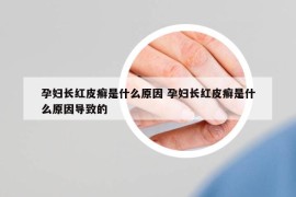 孕妇长红皮癣是什么原因 孕妇长红皮癣是什么原因导致的